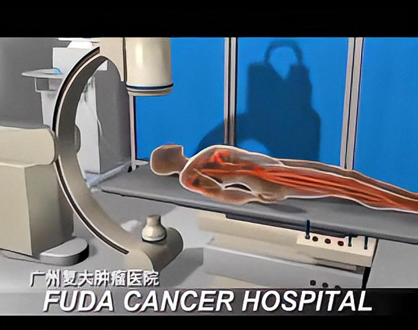 載藥微球(Hepasphere)